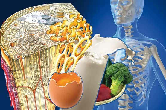 مواد غذایی موثر در پیشگیری از پوکی استخوان