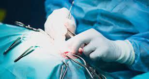 خارج کردن توده ۳ کیلویی از شکم زن اسدآبادی