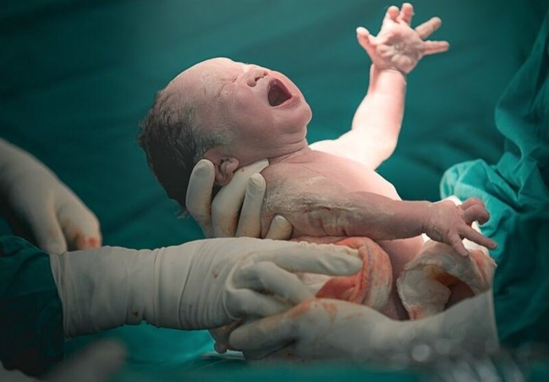 آمار پایین زایمان طبیعی بدون درد در ایران آمار پایین زایمان طبیعی بدون درد در ایران